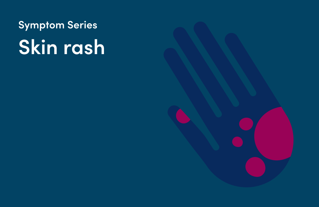 The 21 symptoms of COVID19 to watch out for